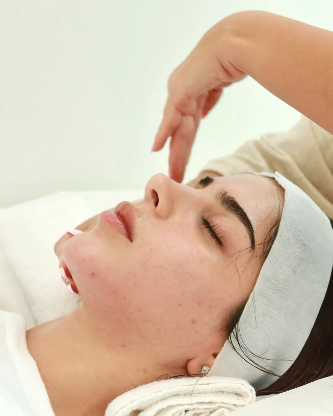 Acne relief facial in Dubai, calming care for breakout-prone skin at AZIZAM beauty salon